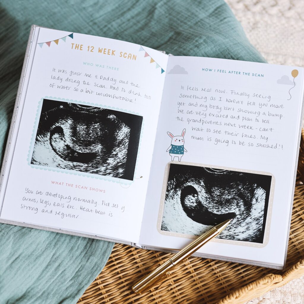 Open book with baby scans stuck on pages.